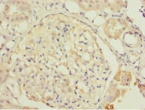 DPYS / Dihydropyrimidinase Antibody