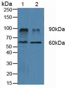 DPP4 / CD26 Antibody (aa484-728)