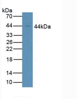 FCGR1A / CD64 Antibody (aa73-294)