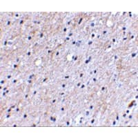 NIPSNAP1 Antibody