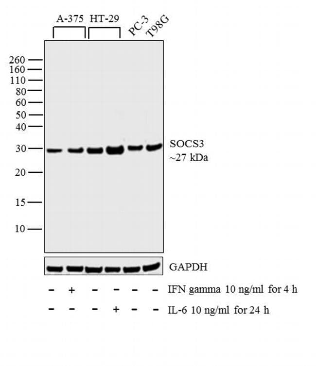 Monoclonal Mouse anti-Human SOCS3 Antibody (clone SO1, IF, WB)