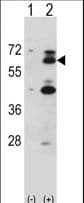 Polyclonal Rabbit anti-Mouse YES1 / c-Yes Antibody (aa1-30, WB)
