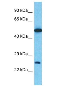 CLEC2D / OCIL / LLT1 Antibody (C-Terminus, Biotin)