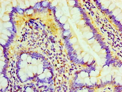 Polyclonal Rabbit anti-Human LIPA / Lysosomal Acid Lipase Antibody (aa22-399, WB)