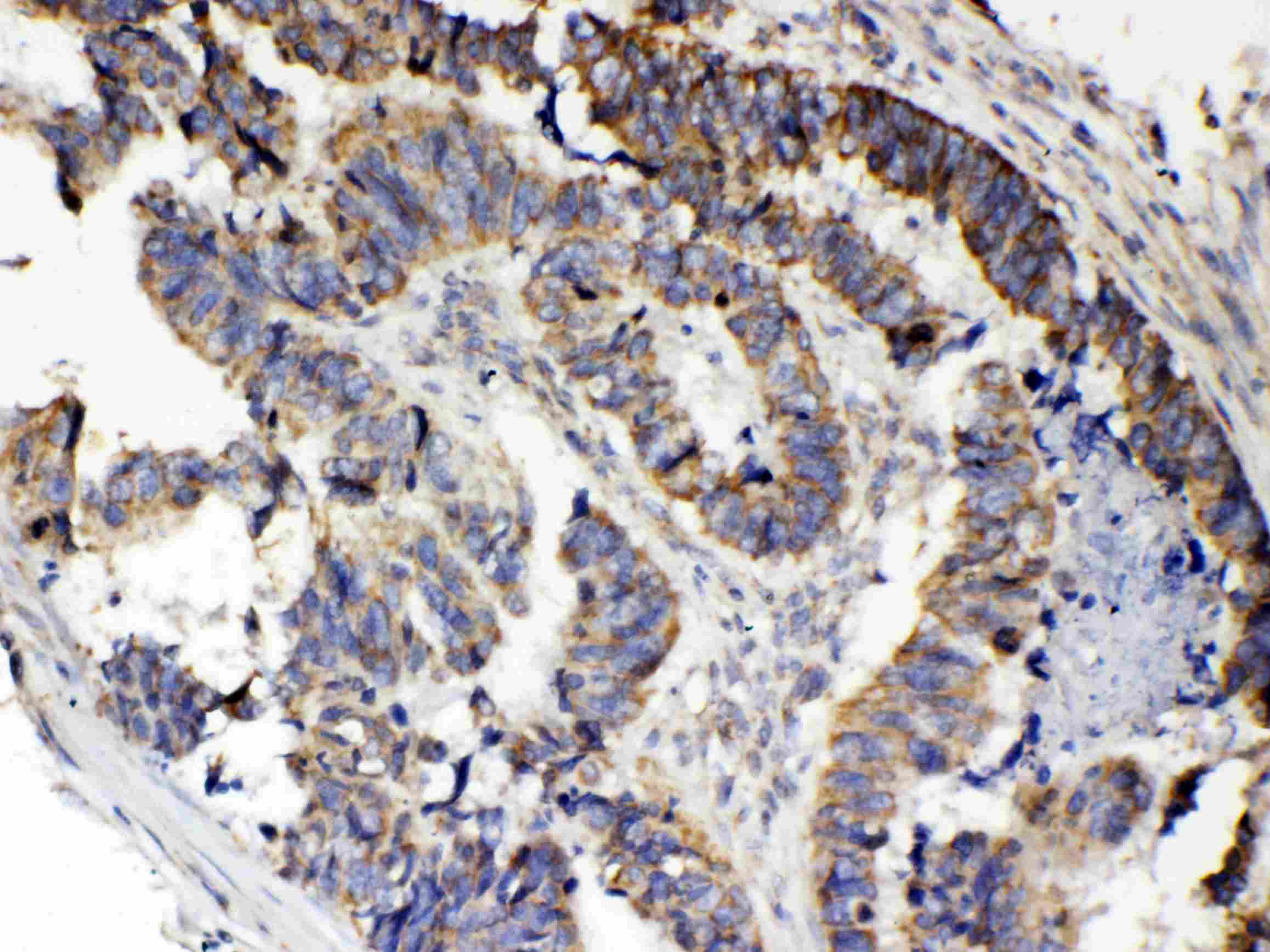TNFRSF11A / RANK Antibody