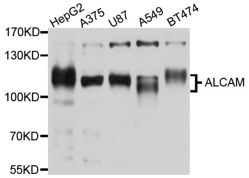 ALCAM / CD166 Antibody