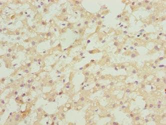 ASAP3 Antibody