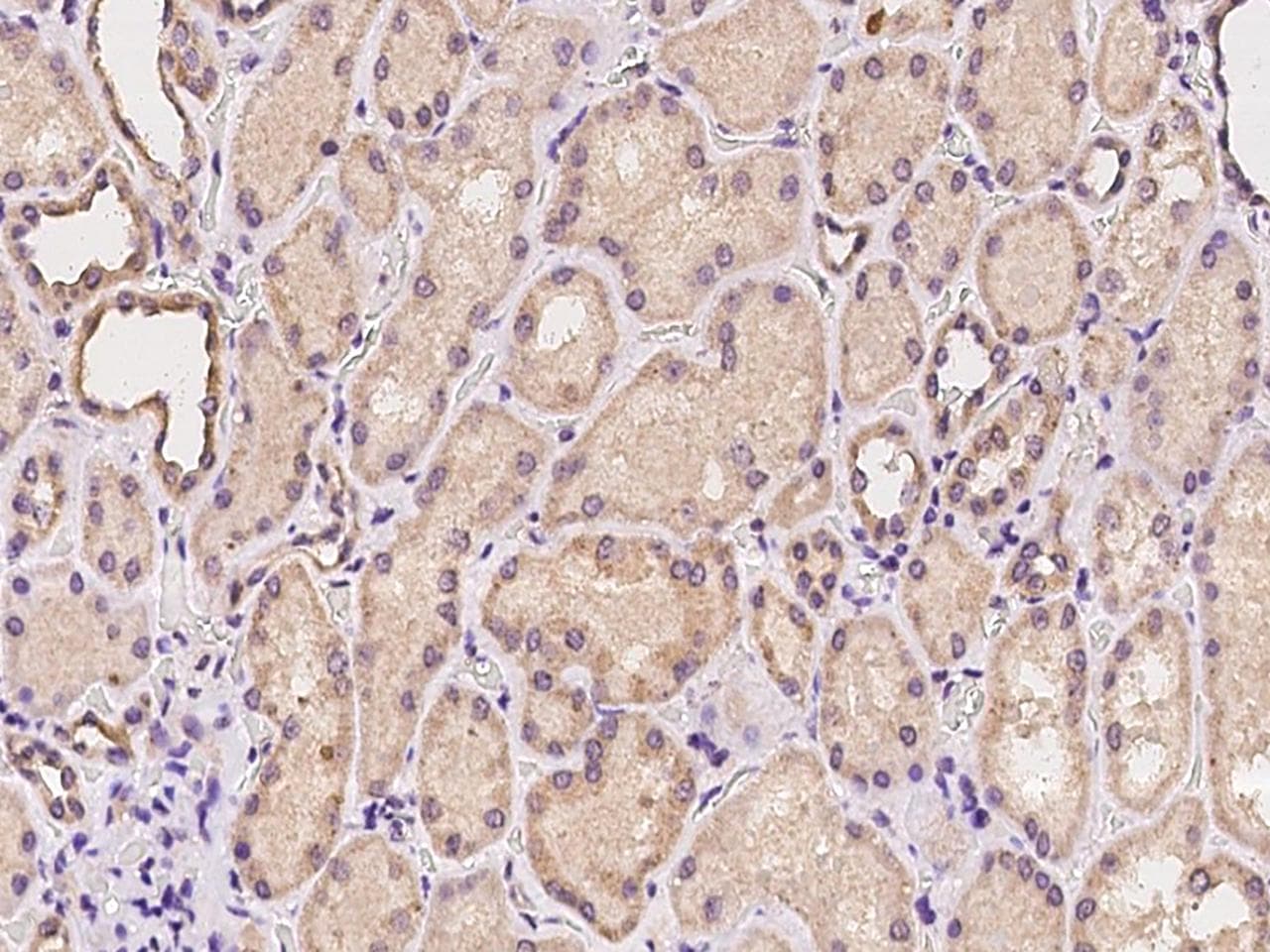 Polyclonal Rabbit anti-Human YKL39 / CHI3L2 Antibody (IHC)