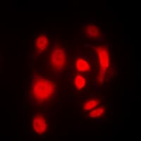 SGK1 / SGK Antibody (phospho-Thr256/253)