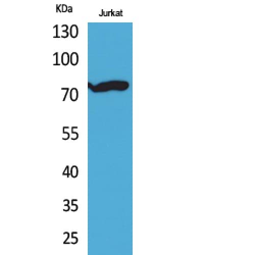 TP73 / p73 Antibody (acetylation site of K327.)