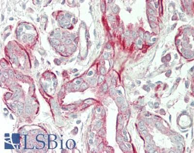 IHC-plus™ TPM4 Antibody (aa26-54)