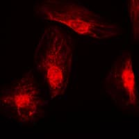 RANBP6 Antibody (Internal)