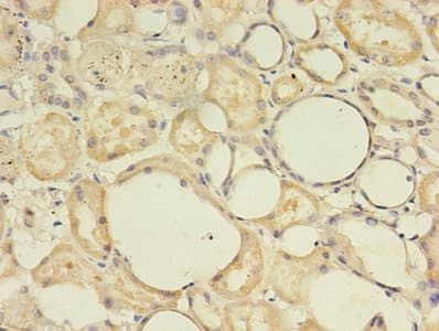 MAS1 / MAS Antibody (aa285-352)