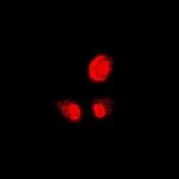 Polyclonal Rabbit anti-Human PSMB1 Antibody (IHC, IF, WB)