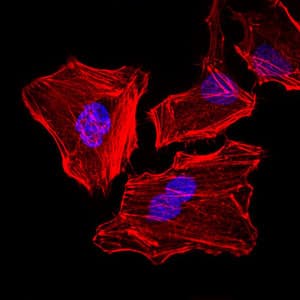 PathPlus™ KRT5 / CK5 / Cytokeratin 5 Antibody (aa158-272, clone 2C2)