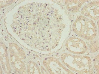Polyclonal Rabbit anti-Human TUBB1 / Tubulin Beta 1 Antibody (IHC, WB)