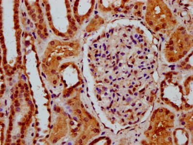 SSDP1 / SSBP3 Antibody