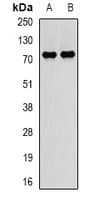 Polyclonal Rabbit anti-Human PADI4 / PAD4 Antibody (IHC, IF, WB)