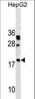 LBX2 Antibody (aa85-113)