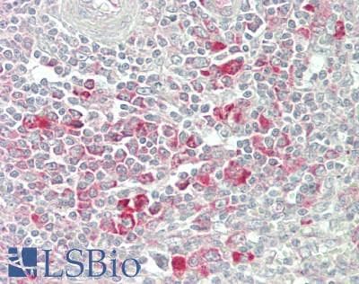 IHC-plus™ Polyclonal Rabbit anti-Human EF1G / EEF1G Antibody (aa200-250, IHC, WB)