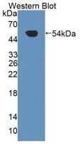 HAVCR1 / KIM-1 Antibody (aa21-240, Cy3)