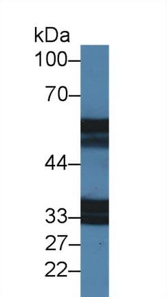 CDw218a / IL18R1 Antibody (aa182-336)