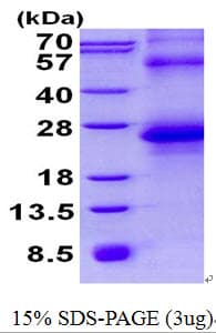 Human SPINT2 / HAI-2 Protein (Recombinant His)