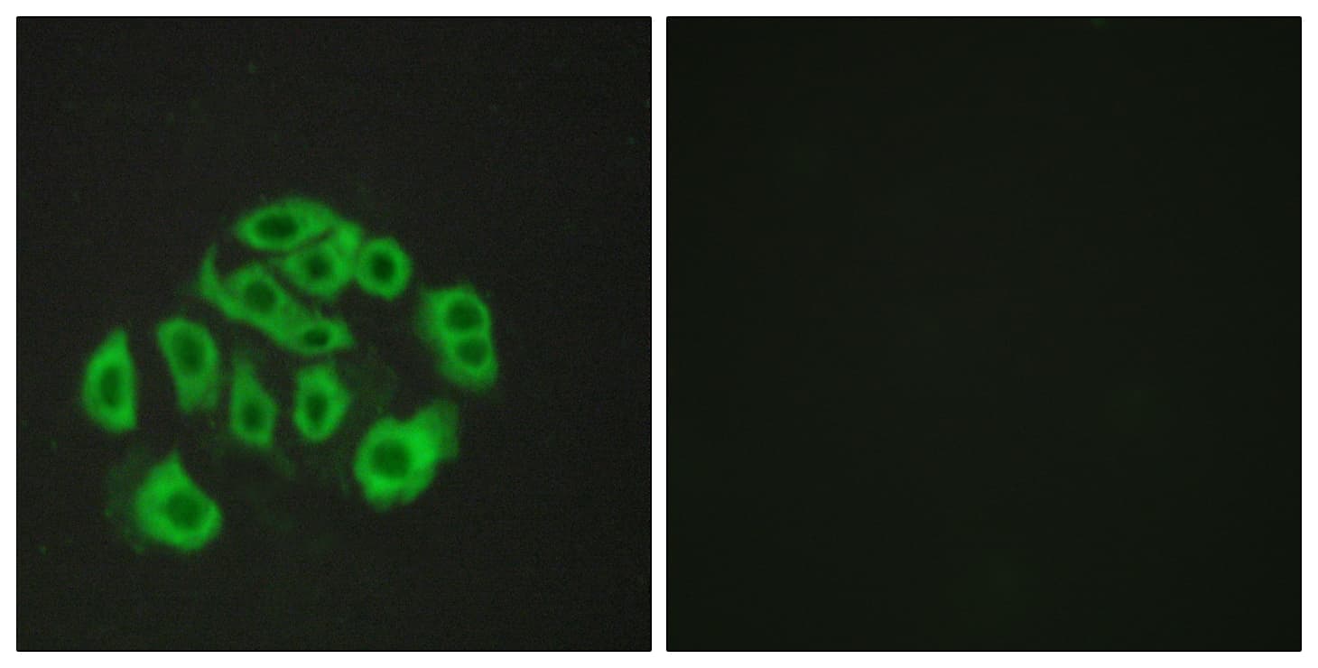 Polyclonal Rabbit anti-Human EMCN / Endomucin Antibody (aa201-250, IF)