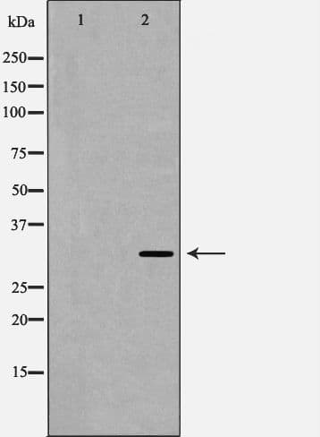 TNFAIP6 / TSG-6 Antibody