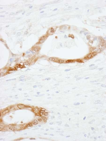 Polyclonal Rabbit anti-Human CRABP2 Antibody (aa80-C-term, IHC, WB)
