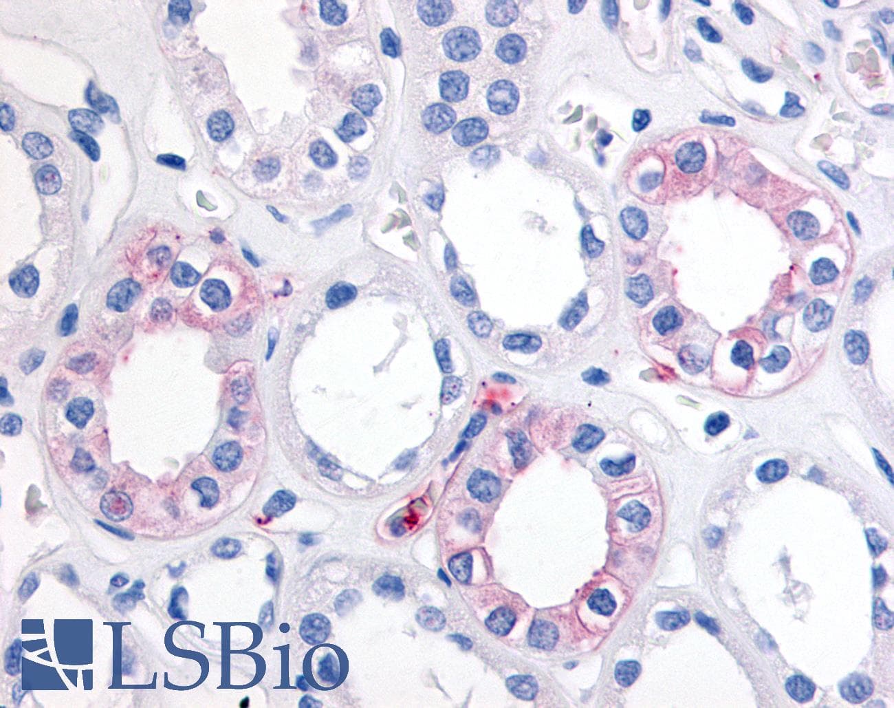 IHC-plus™ EPHX2 / Epoxide Hydrolase 2 Antibody (Internal)