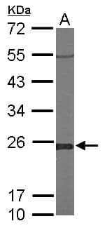 IHC-plus™ GLO1 / Glyoxalase I Antibody (aa1-184)