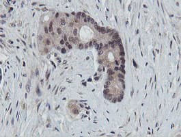 PROSC Antibody (clone OTI3G7)