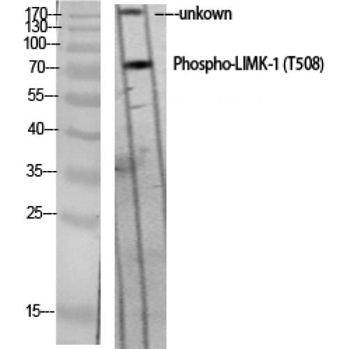 LIMK1 / LIMK Antibody (440-520 aa)