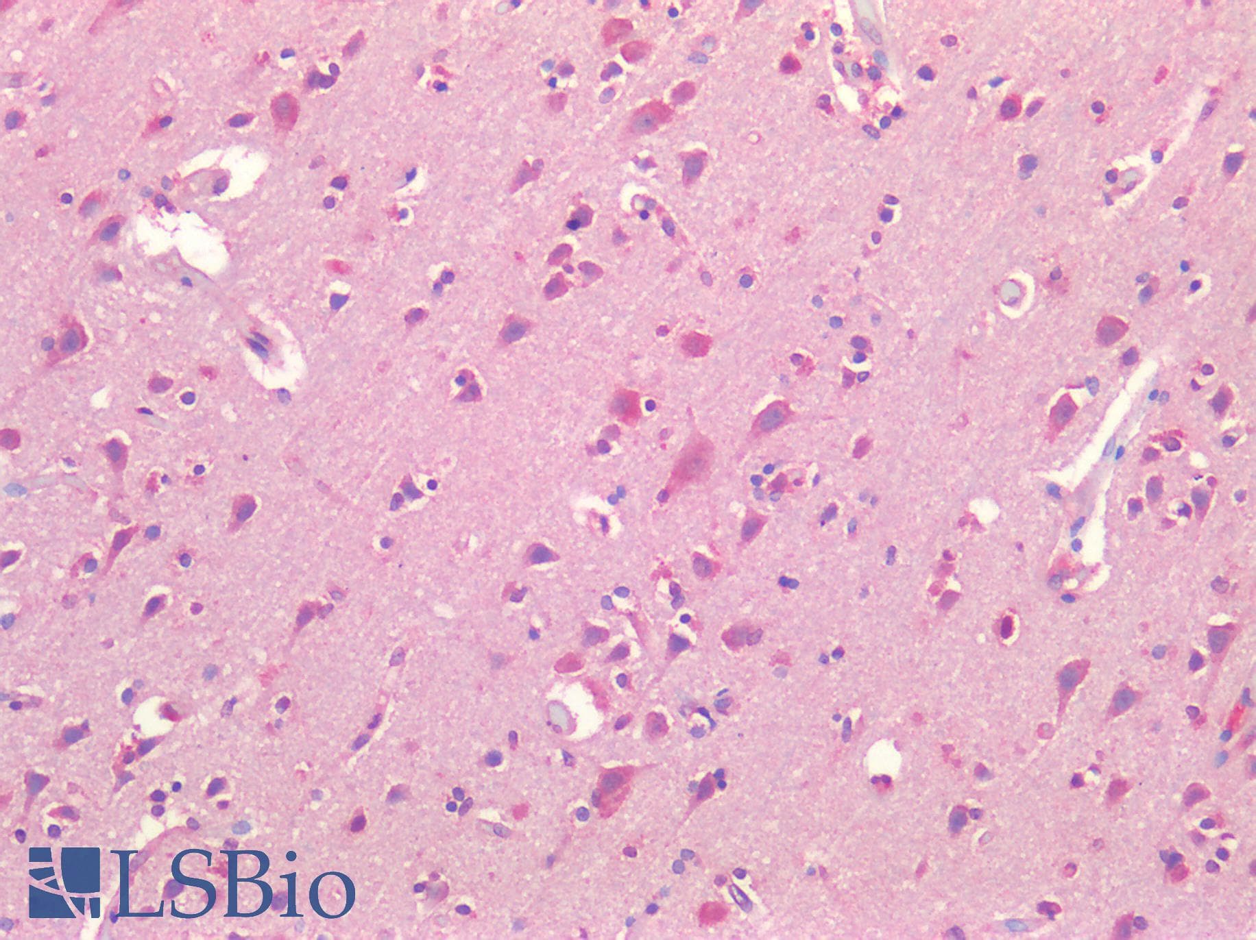 IHC-plus™ Polyclonal Rabbit anti-Human FOLH1 / PSMA Antibody (IHC)