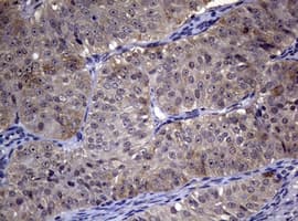 R1 / RRM1 Antibody (aa541-792, clone OTI5G5, Carrier-free)