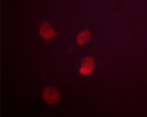MDM2 Antibody (phospho-Ser166)