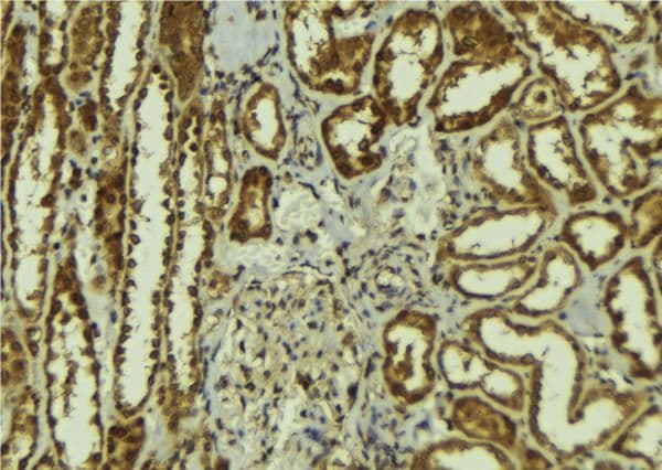 CS1 / CLSTN1 Antibody