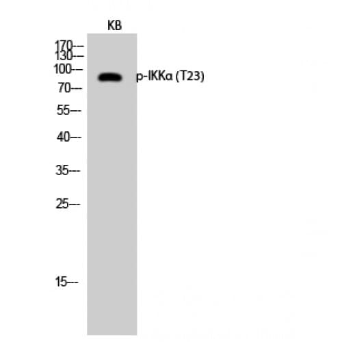 CHUK / IKKA / IKK Alpha Antibody (10-90 aa)