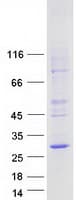 Human LAPTM5 Protein (Recombinant Myc-DDK (Flag))