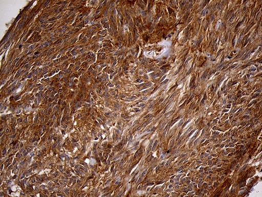 PYGM Antibody (aa698-842, clone OTI3F9)