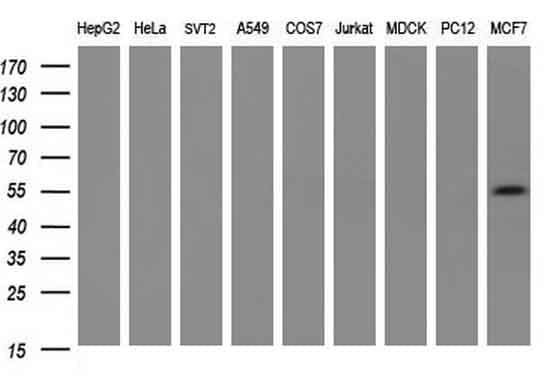 Monoclonal Mouse anti-Human PKM2 Antibody (clone 1F12, IHC, WB)