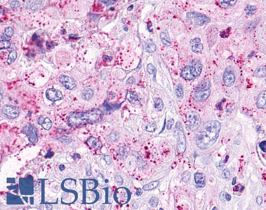 PathPlus™ OXER1 Antibody (C-Terminus)