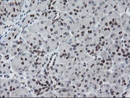 Monoclonal Mouse anti-Human MEIS3 Antibody (clone OTI3C9, IHC, WB)