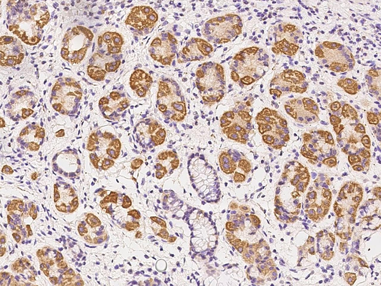 Polyclonal Rabbit anti-Human SIX4 Antibody (IHC, IF)