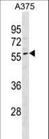 DPCR1 Antibody (aa165-191)