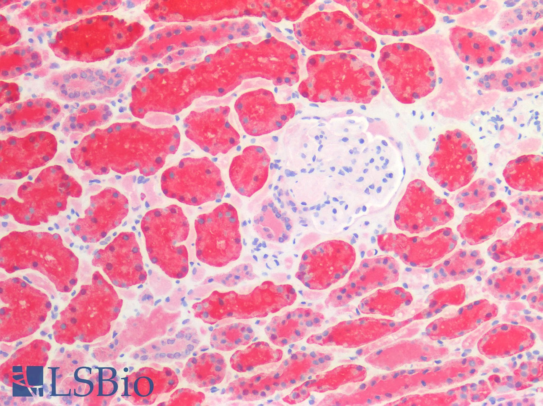 IHC-plus™ Polyclonal Rabbit anti-Human HSPD1 / HSP60 Antibody (IHC, WB)
