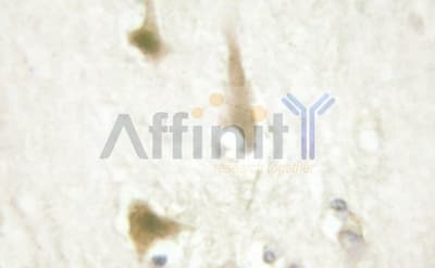 CCND1 / Cyclin D1 Antibody