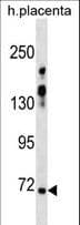 ZNF251 Antibody (aa154-182)