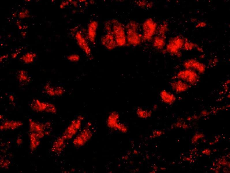 SF3B2 Antibody (aa775-825)